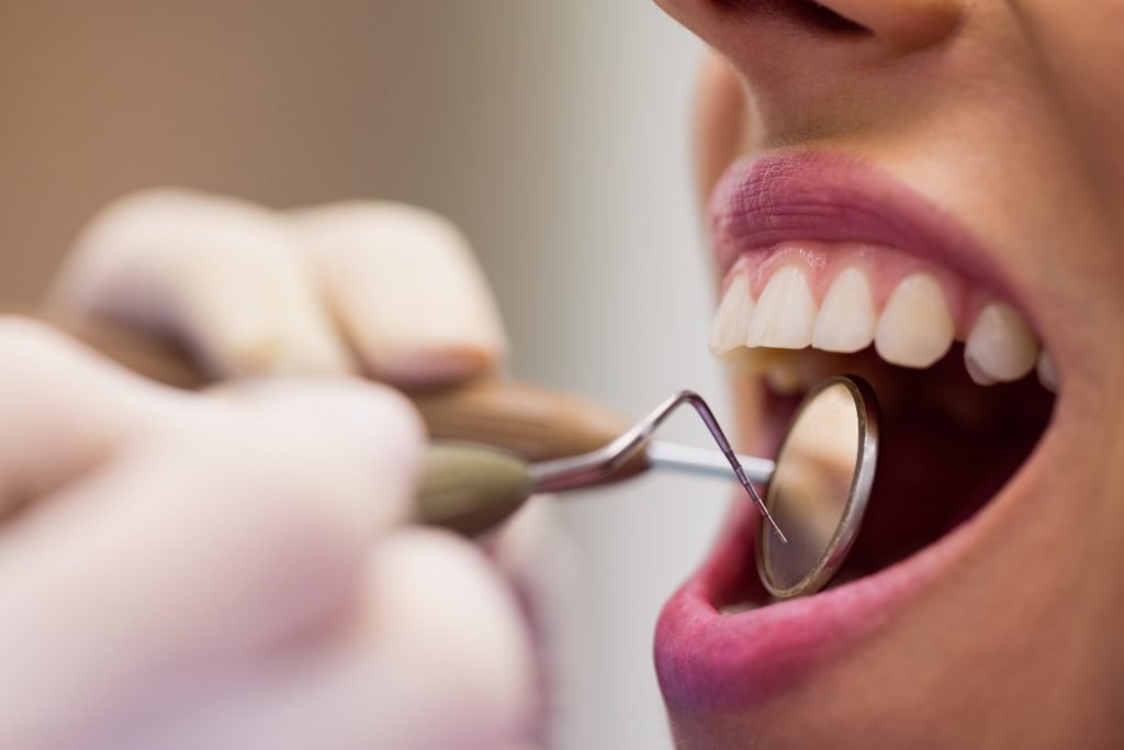 Examinando a un paciente las caries en los dientes