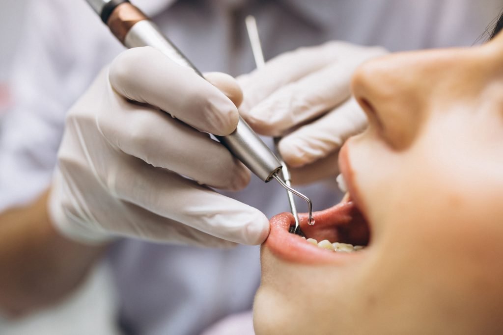Dentadura dental con una mala higiene oral
