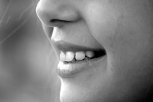 Mujer con caries dental