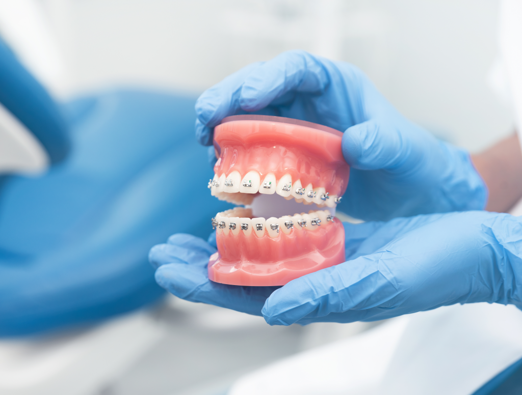 Beneficios de la ortodoncia
