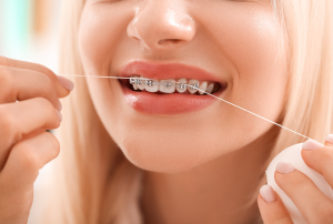 Tipos de brackets